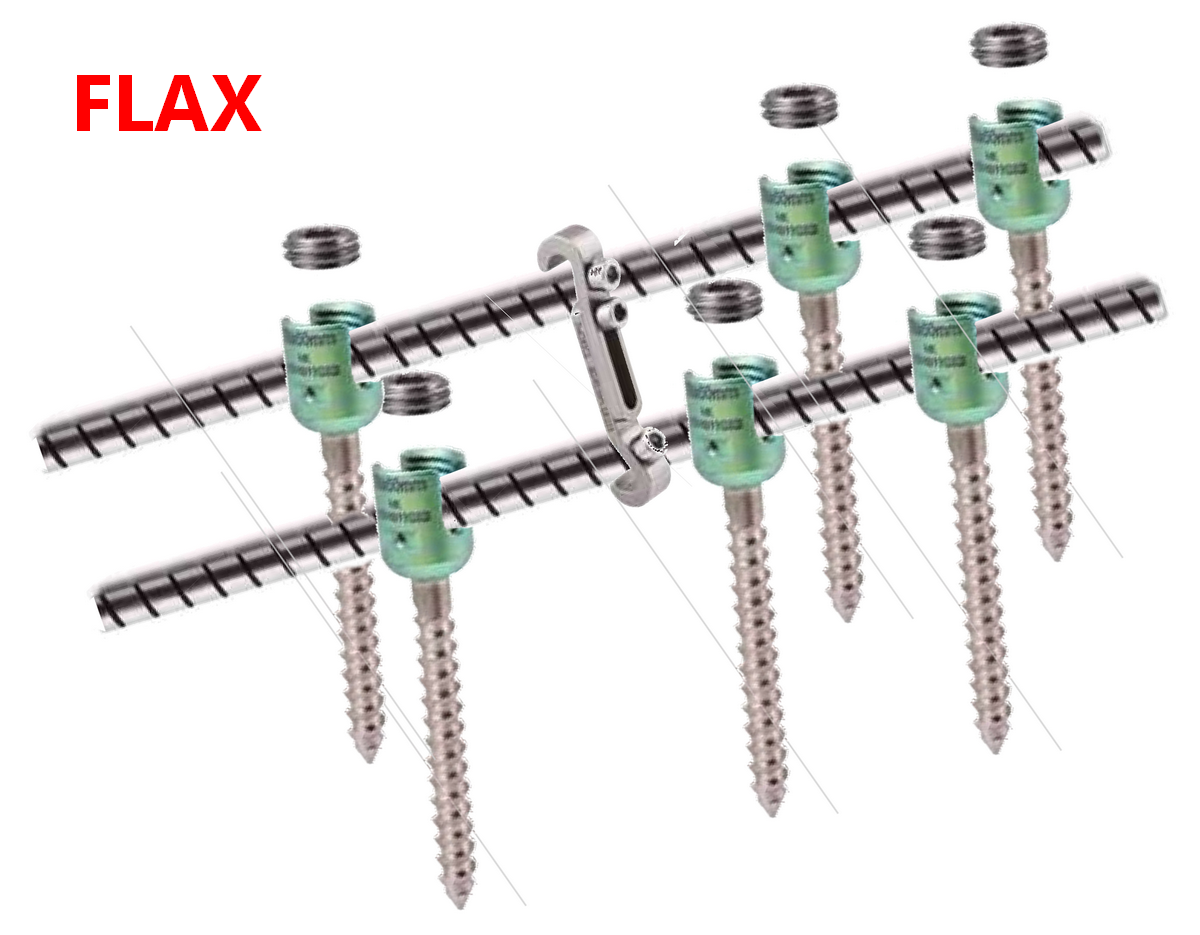 Транспедикулярна конструкція з гнучкими стрижнями FLAX (6 гвинта) Medical Concept